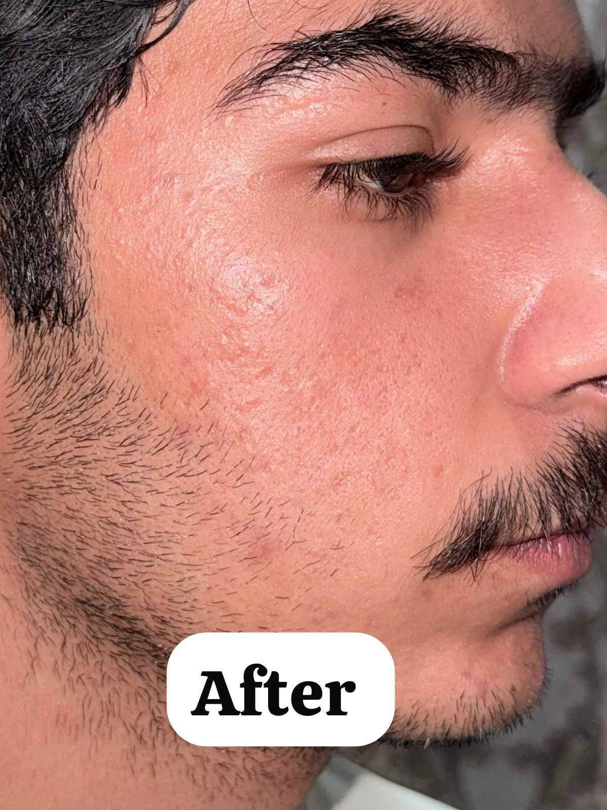 Glycolic Acid Serum