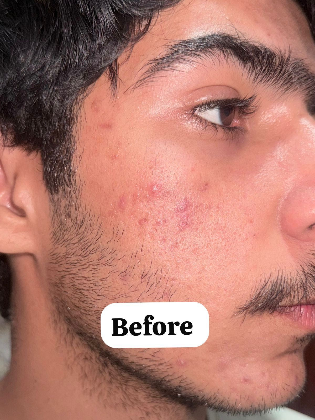 Glycolic Acid Serum